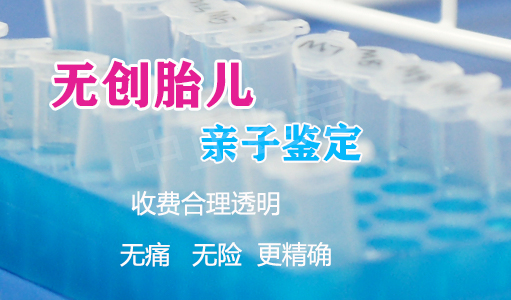 徐州产前亲子鉴定需要如何做, 徐州产前亲子鉴定需要如何做,